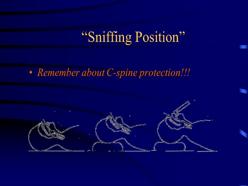 “Sniffing Position” Remember about C-spine protection!!!